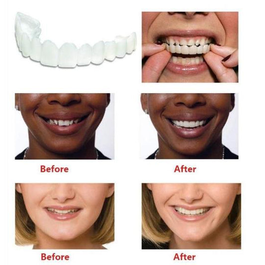 Instant Smile - Snap on a perfect and confident smile every time!