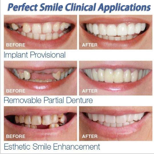 Instant Smile - Snap on a perfect and confident smile every time!