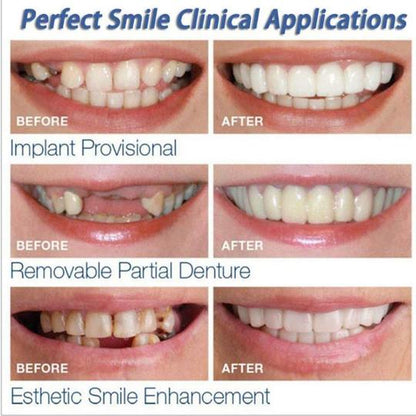 Instant Smile - Snap on a perfect and confident smile every time!